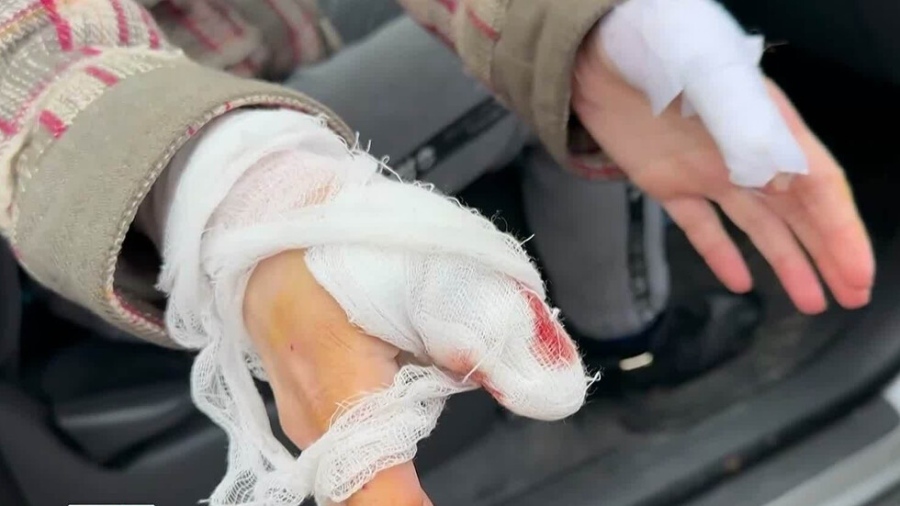 Агресивно куче нахапа жена и нейното куче по време на разходка в Казанлък