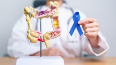 Ракът на дебелото черво взема 2000 жертви годишно у нас